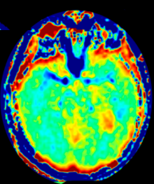 DICOM Viewer