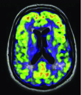 Medical Image Registration